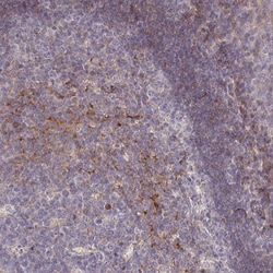 RPL23A Antibody, Novus Biologicals 0.1mL; Unlabeled:Antibodies, Polyclonal